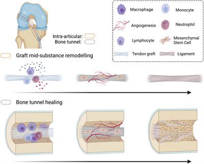 Tackling the Challenges of Graft Healing After Anterior Cruciate Ligament Reconstruction—Thinking From the Endpoint